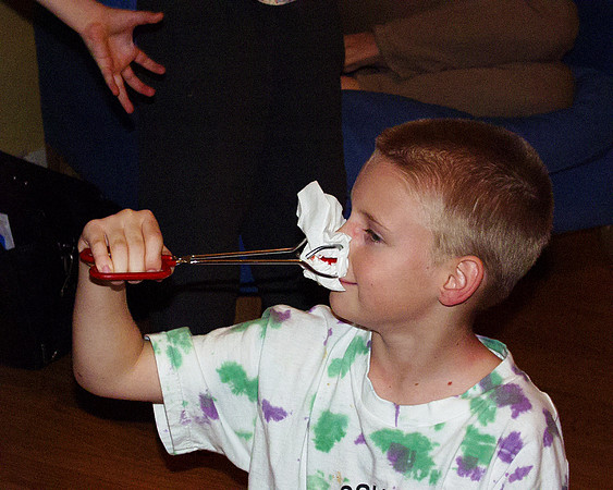 20001124 Zack's bloody nose